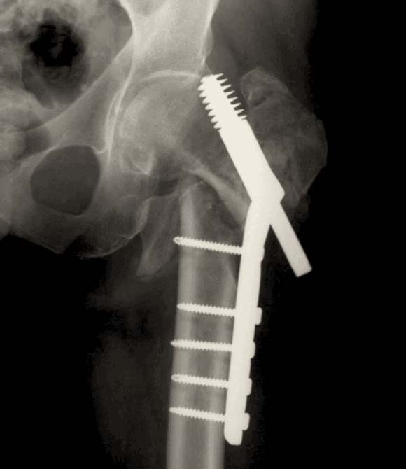 Ortho Reviews - Image