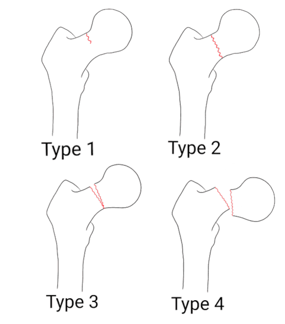 Ortho Reviews - Image