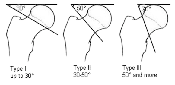 Ortho Reviews - Image