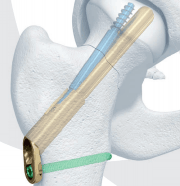 Ortho Reviews - Image