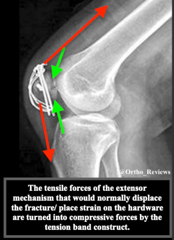 Ortho Reviews - Image